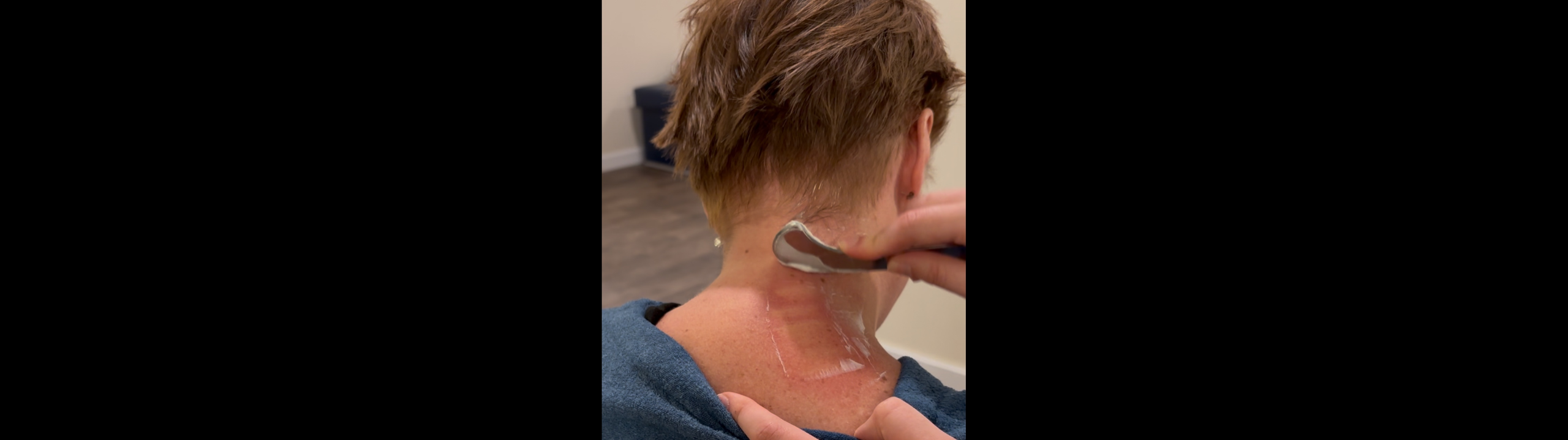 The Benefits of Graston Technique for Muscles in Combination with Chiropractic Care