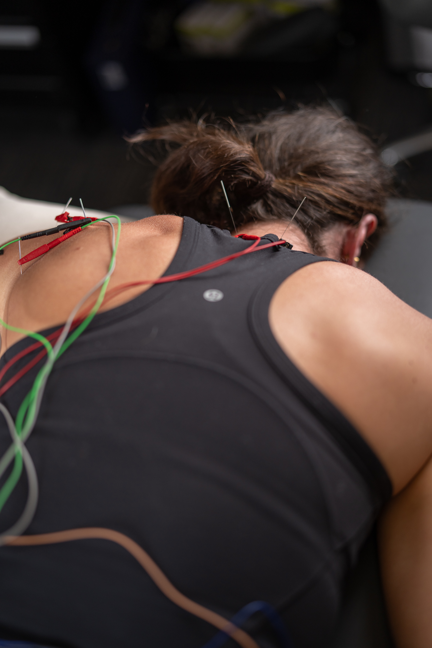 physical therapist working with a patient during dry needling