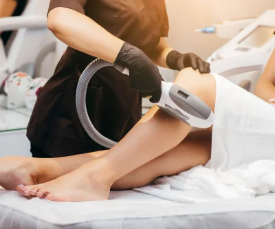laser hair removal