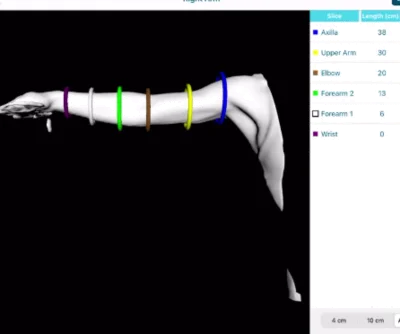 lymphatech 3d imaging