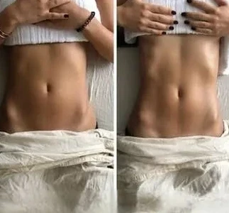 Experience the magic of skin tightening!