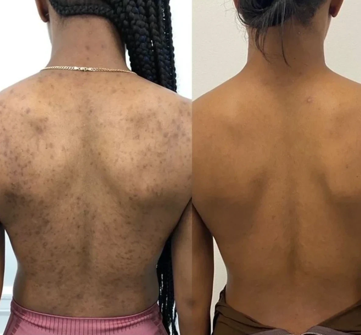 Unlock Your Skin’s True Potential